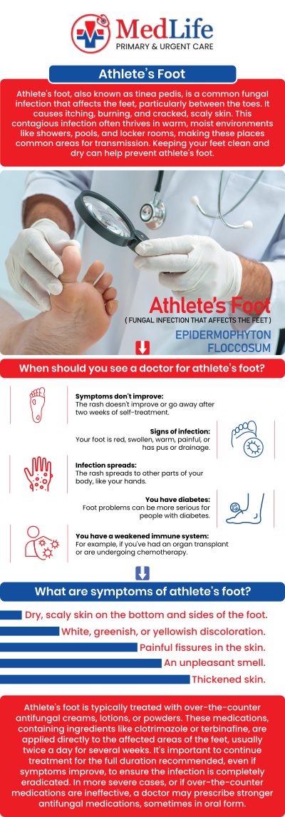 Common questions asked by patients: What causes athlete’s foot and fungal infections to develop? How can you tell if a foot rash is athlete’s foot? Can athlete’s foot spread to other parts of the body? Why does athlete’s foot sometimes keep coming back? For more information, contact us or request an appointment online. We are conveniently located at 2035 Flat Shoals Rd SE, Conyers, GA 30013. We serve patients from Conyers GA, Covington GA, Lakeview Estates GA, Stonecrest GA, and surrounding areas. Common questions asked by patients: What causes athlete’s foot and fungal infections to develop? How can you tell if a foot rash is athlete’s foot? Can athlete’s foot spread to other parts of the body? Why does athlete’s foot sometimes keep coming back? For more information, contact us or request an appointment online. We are conveniently located at 2035 Flat Shoals Rd SE, Conyers, GA 30013. We serve patients from Conyers GA, Covington GA, Lakeview Estates GA, Stonecrest GA, and surrounding areas.