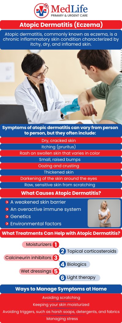 Common questions asked by patients: What are the common symptoms of atopic dermatitis? What causes atopic dermatitis to flare up? How is atopic dermatitis diagnosed? Can atopic dermatitis affect both children and adults? For more information, contact us or request an appointment online. We are conveniently located at 2035 Flat Shoals Rd SE, Conyers, GA 30013. We serve patients from Conyers GA, Covington GA, Lakeview Estates GA, Stonecrest GA, and surrounding areas.