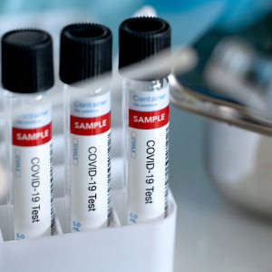 COVID Testing in McDonough, Buford, Norcross, Winder, Flowery Branch, and Conyers, GA