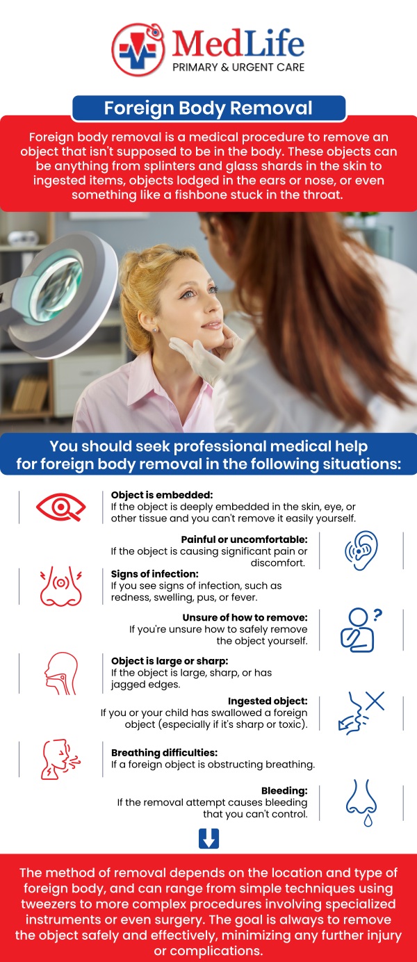 Common questions asked by patients: What types of objects may require foreign body removal? When should I seek medical care for foreign body removal? How is foreign body removal performed? Can foreign body removal be done at urgent care? For more information, contact us or request an appointment online. We are conveniently located at 2035 Flat Shoals Rd SE, Conyers, GA 30013. We serve patients from Conyers GA, Covington GA, Lakeview Estates GA, Stonecrest GA, and surrounding areas. Common questions asked by patients: What types of objects may require foreign body removal? When should I seek medical care for foreign body removal? How is foreign body removal performed? Can foreign body removal be done at urgent care? For more information, contact us or request an appointment online. We are conveniently located at 2035 Flat Shoals Rd SE, Conyers, GA 30013. We serve patients from Conyers GA, Covington GA, Lakeview Estates GA, Stonecrest GA, and surrounding areas.