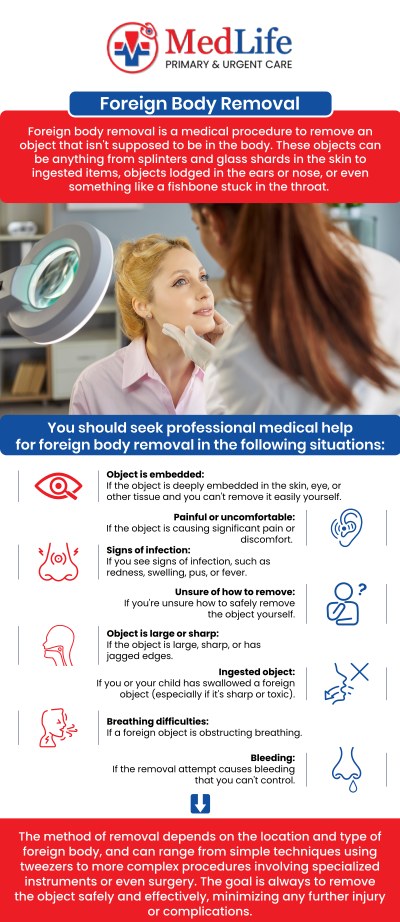 Common questions asked by patients: What types of objects may require foreign body removal? When should I seek medical care for foreign body removal? How is foreign body removal performed? Can foreign body removal be done at urgent care? For more information, contact us or request an appointment online. We are conveniently located at 2035 Flat Shoals Rd SE, Conyers, GA 30013. We serve patients from Conyers GA, Covington GA, Lakeview Estates GA, Stonecrest GA, and surrounding areas. Common questions asked by patients: What types of objects may require foreign body removal? When should I seek medical care for foreign body removal? How is foreign body removal performed? Can foreign body removal be done at urgent care? For more information, contact us or request an appointment online. We are conveniently located at 2035 Flat Shoals Rd SE, Conyers, GA 30013. We serve patients from Conyers GA, Covington GA, Lakeview Estates GA, Stonecrest GA, and surrounding areas.