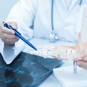 Gout Treatment in McDonough, Buford, Norcross, Winder, Flowery Branch, and Conyers, GA