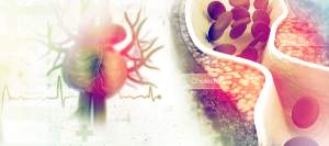 Hyperlipidemia Treatment Clinic in Buford GA
