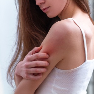 Insect Bites Treatment in McDonough, Buford, Norcross, Winder, Flowery Branch, and Conyers, GA