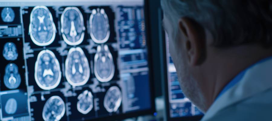 What to Expect During a Neuro Scan in Conyers, GA