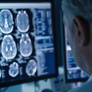 Neuro Scan in McDonough, Buford, Norcross, Winder, Flowery Branch, and Conyers, GA