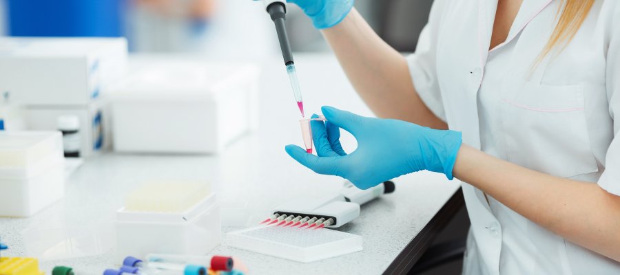 Occult Blood Testing Clinic in Flowery Branch, GA Occult Blood Testing Clinic in Flowery Branch, GA