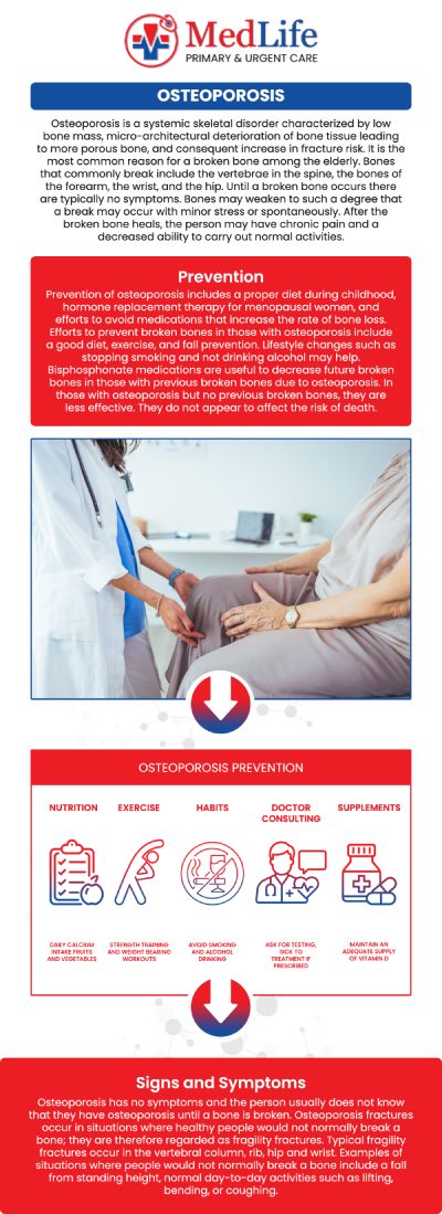 Common questions asked by patients: What is osteoporosis? What are the main risk factors for osteoporosis? How can osteoporosis be prevented? What are the symptoms of osteoporosis? For more information, contact us or request an appointment online. We are conveniently located at 2129 Friendship Rd Buford, GA 30519. We serve patients from Buford GA, Mulberry GA, Sugar Hill GA, Dacula GA, Suwanee GA, Lawrenceville GA, Gainesville GA, and surrounding areas. Common questions asked by patients: What is osteoporosis? What are the main risk factors for osteoporosis? How can osteoporosis be prevented? What are the symptoms of osteoporosis? For more information, contact us or request an appointment online. We are conveniently located at 2129 Friendship Rd Buford, GA 30519. We serve patients from Buford GA, Mulberry GA, Sugar Hill GA, Dacula GA, Suwanee GA, Lawrenceville GA, Gainesville GA, and surrounding areas.