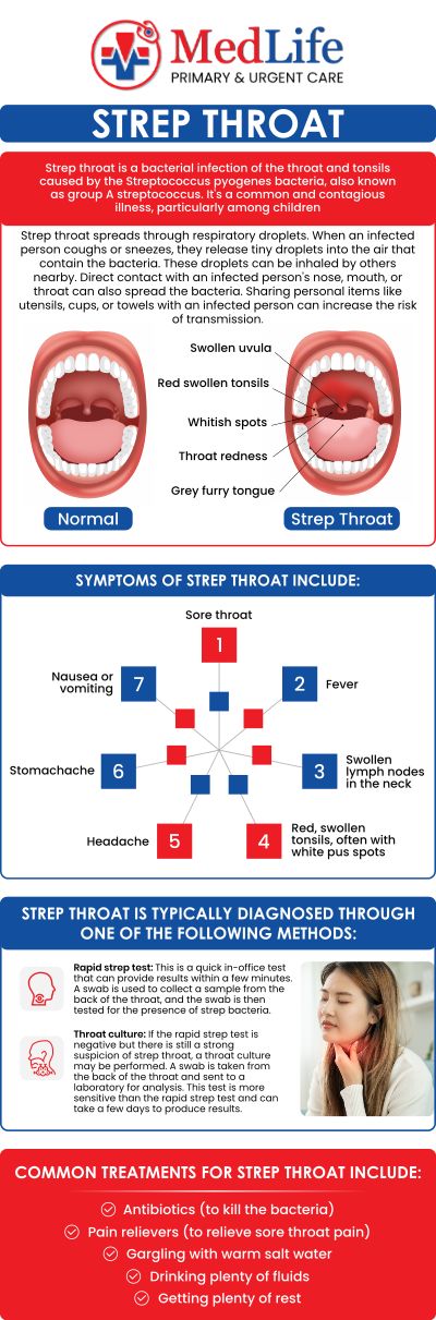 Common questions asked by patients: What is strep throat? What are the symptoms of strep throat? Is strep throat contagious? How is strep throat treated? For more information, contact us or request an appointment online. We are conveniently located at 2035 Flat Shoals Rd SE, Conyers, GA 30013. We serve patients from Conyers GA, Covington GA, Lakeview Estates GA, Stonecrest GA, and surrounding areas.