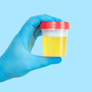 Urinalysis in McDonough, Buford, Norcross, Winder, Flowery Branch, and Conyers, GA