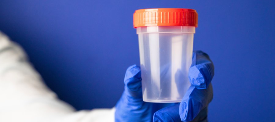 Urine Drug Testing Clinic in Buford, GA Urine Drug Testing Clinic in Buford, GA