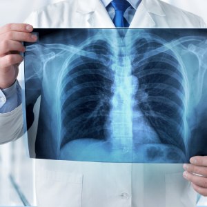 X-Ray in McDonough, Buford, Norcross, Winder, Flowery Branch, and Conyers, GA