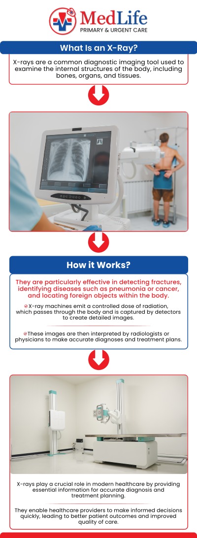 At MedLife Primary & Urgent Care in Winder, GA, we eliminate the stress, long wait times, and high costs of emergency room visits by offering fast, on-site digital X-rays for urgent medical needs. Whether you are dealing with a suspected bone fracture, painful joint sprain, deep tissue injury, or acute chest congestion, our experienced team delivers immediate diagnostic imaging right when you need it most. For more information, contact us or request an appointment online. We are located at 24 Amherst Dr, Winder, GA 30680. At MedLife Primary & Urgent Care in Winder, GA, we eliminate the stress, long wait times, and high costs of emergency room visits by offering fast, on-site digital X-rays for urgent medical needs. Whether you are dealing with a suspected bone fracture, painful joint sprain, deep tissue injury, or acute chest congestion, our experienced team delivers immediate diagnostic imaging right when you need it most. For more information, contact us or request an appointment online. We are located at 24 Amherst Dr, Winder, GA 30680.